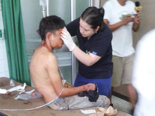 Honduras: Tres muertos y más de 32 heridos en accidente vial