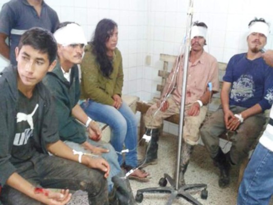 Honduras: Tres muertos y más de 32 heridos en accidente vial