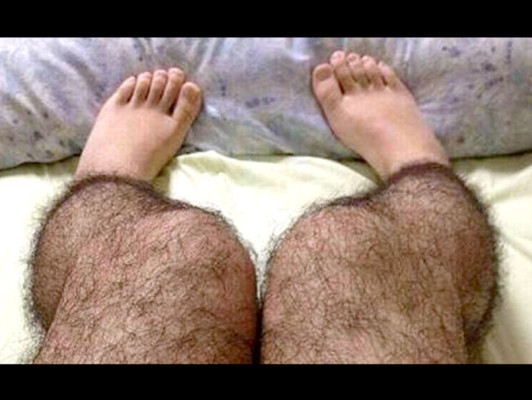 Medias antivioladores