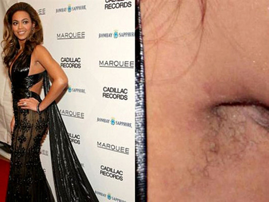 Los descuidos de depilación de las famosas