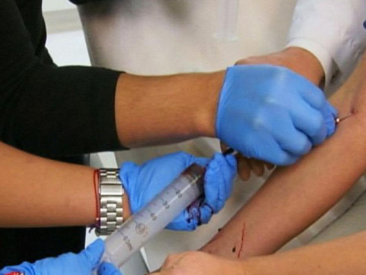 La cara ensangrentada de Kim Kardashian