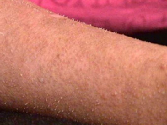 Uñas en vez de pelo