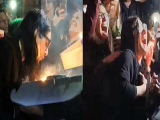 Skrillex se incendia el cabello