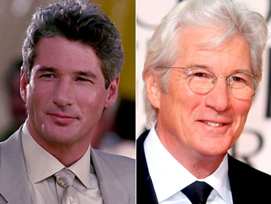 El antes y después de los famosos