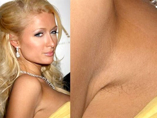 Los descuidos de depilación de las famosas