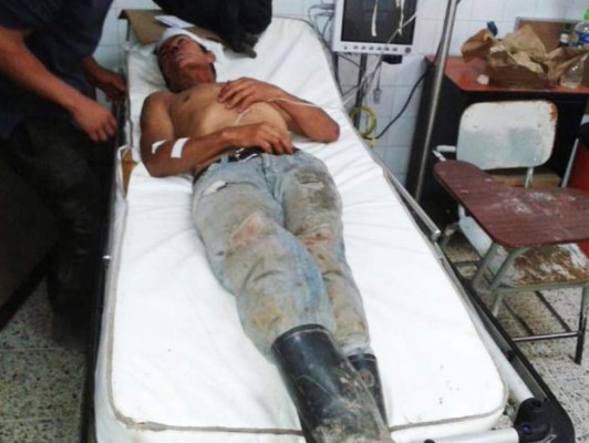 Honduras: Tres muertos y más de 32 heridos en accidente vial