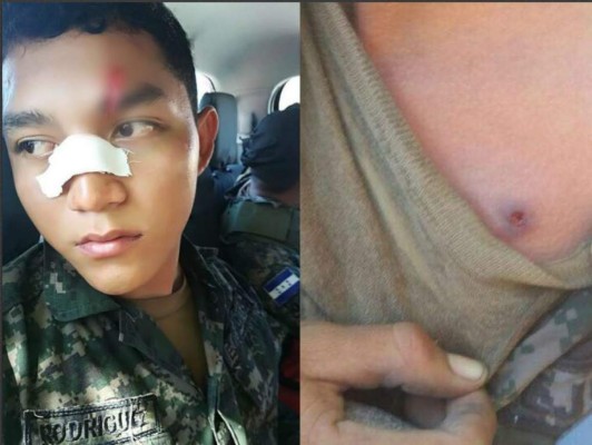 Momentos de incertidumbre viven ciudadanos tras disturbios en los barrios de Choluteca