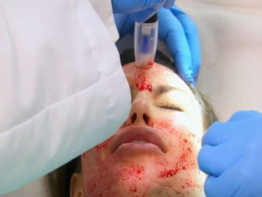 La cara ensangrentada de Kim Kardashian