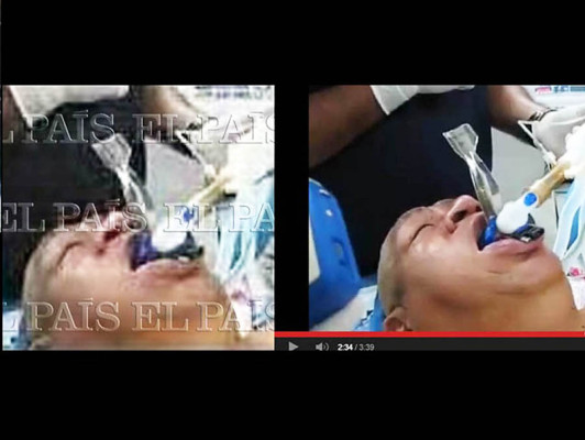 Polémica mundial por supuesta foto de Hugo Chávez entubado