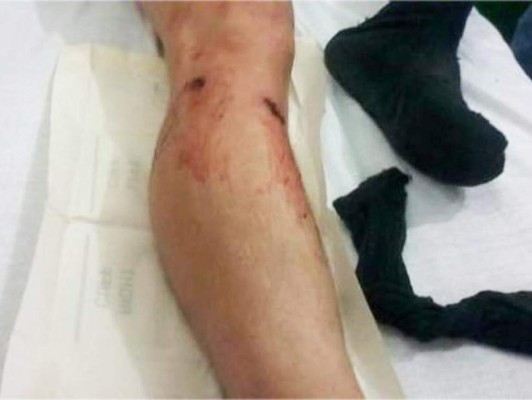 Honduras: Dos heridos en atentado contra patrulla militar