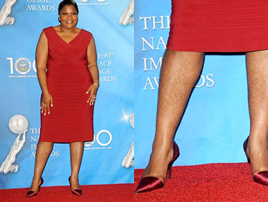 Los descuidos de depilación de las famosas