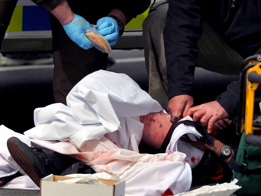 Las amputaciones, gran drama de los atentados en Boston