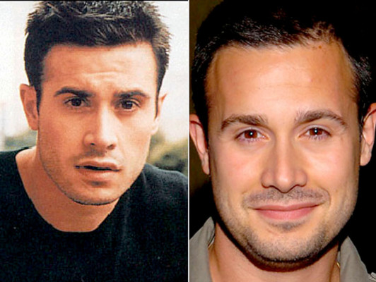 El antes y después de los famosos