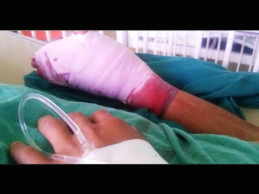 Honduras: Explota batería de celular en la mano de un niño