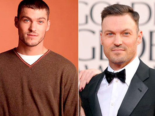 El antes y después de los famosos