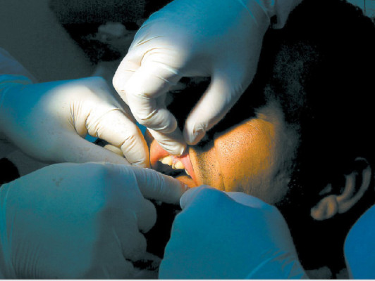 Incrementan casos de disfunción mandibular