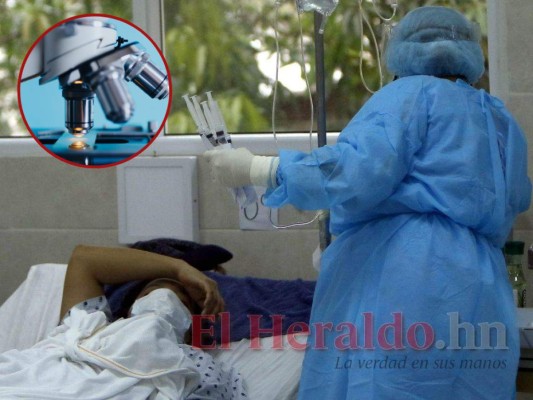 Confirman el tercer caso de hongo negro en Honduras; hay seis sospechosos más