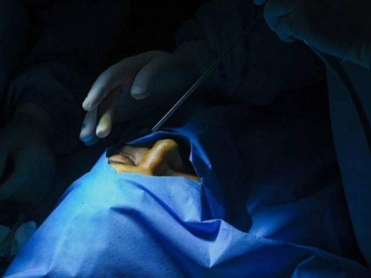 Estas son las 10 cosas que debes conocer sobre el hongo negro