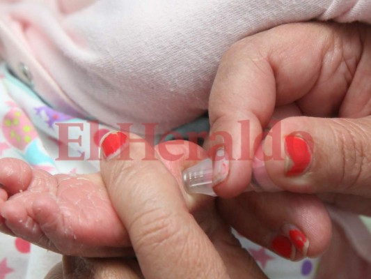 Doce casos de niños con enfermedad de Kawasaki en el HEU