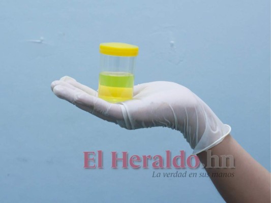 Las pruebas caseras de embarazo más extrañas