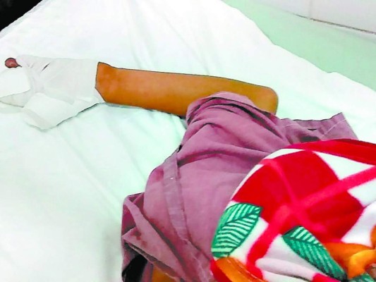 Niño de 13 años es el primer quemado por pólvora de la temporada navideña de 2019