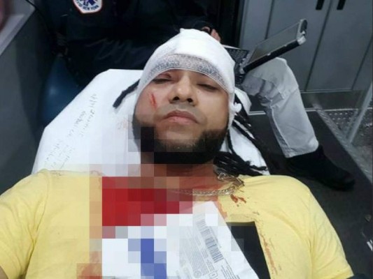 Pandilleros apuñalan a Mala Fe, cantante de 'La vaca', en Nueva York