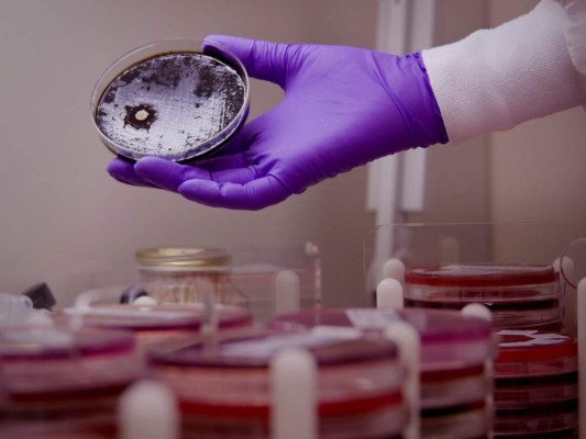 Salud adquirirá medicamentos en EEUU para pacientes con hongo negro