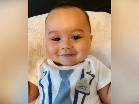 Zane, el bebé milagro nombrado portavoz de Gerber 2021