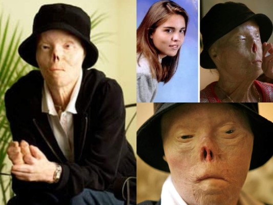 Muere Jacqui Saburido, la venezolana que se convirtió en el rostro de tragedias por conductores ebrios&nbsp;&nbsp;