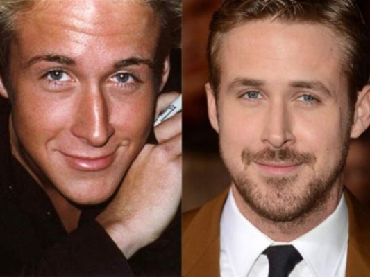 Famosos y sus cambios difíciles de ocultar