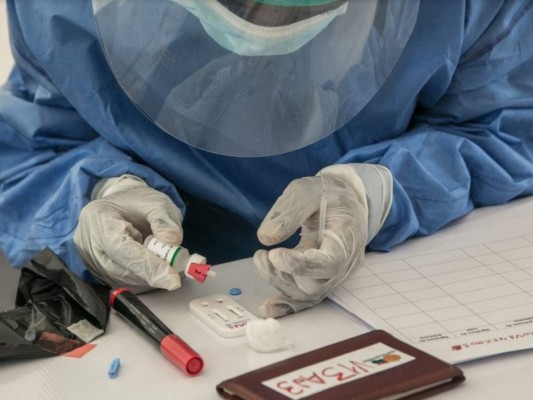 Masiva compra de medicamentos para MAIZ y Catracho, tratamientos contra el Covid-19