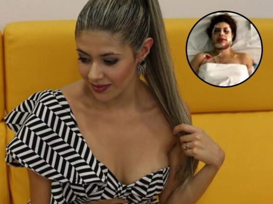 Naela, la cantante colombiana que sufrió 47 fracturas en su rostro