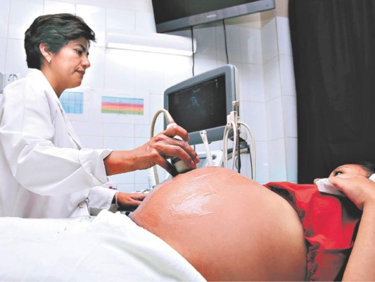 Honduras: Salud espera en agosto oleada de microcefalia