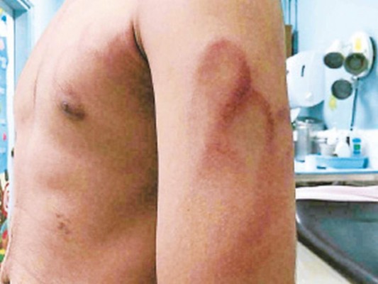 Honduras: Ministerio Público investiga golpiza de médico a menor de edad con un bate de béisbol