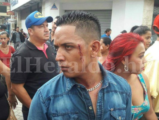 Vendedores ambulantes y policías municipales se enfrentan en el centro de Tegucigalpa