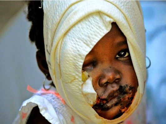 Inolvidables 16 fotos ganadoras del Pulitzer (a 104 años de su muerte)