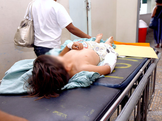 Niño cercena mano de su hermano de tres años