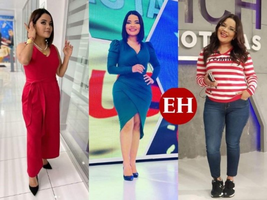 El antes y después de Ariela Cáceres tras su cirugía estética