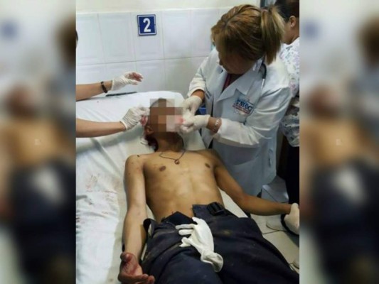 Policía murió en un hospital tras resultar herido en una persecusión a delincuentes en Comayagua