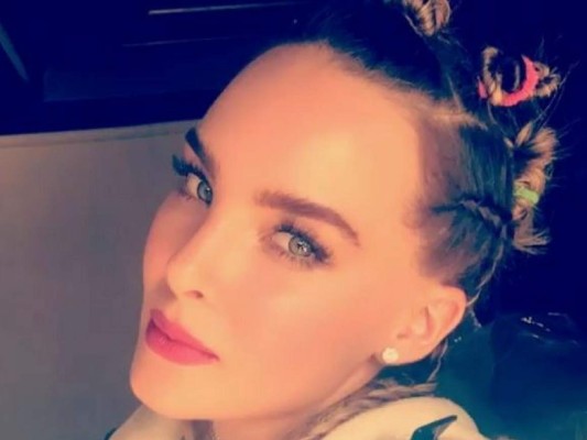 Belinda asusta a sus fans con raro cambio en sus piernas ¿Qué le pasó?