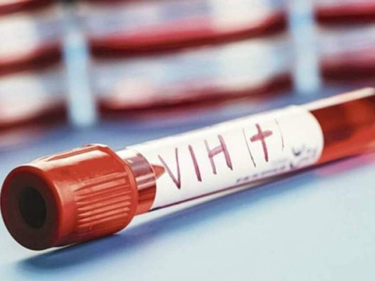 Aumentan en 20% los casos nuevos de VIH en Latinoamérica