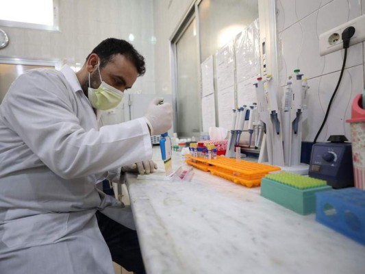 Coronavirus en Honduras: Lo que debe saber hasta este sábado 28 de marzo