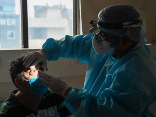 Salud confirma primer caso de hongo negro en Honduras