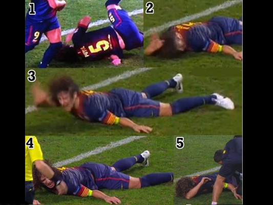 Video: La espeluznante lesión de Carles Puyol