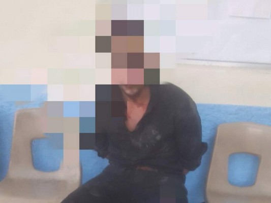 Enfrentamiento deja un supuesto ladrón muerto y un policía herido