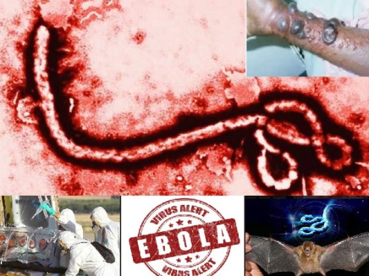 Las razones para temerle al ébola