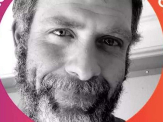 Desgarrador: así quedó el brazo de un trabajador de 'Rust' tras mordedura de araña venenosa