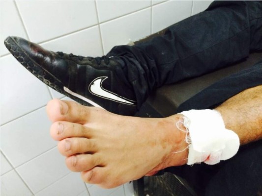 Dos muertos en tiroteo de supuestos 'Revos' en la capital de Honduras