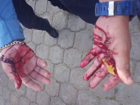 Policías matan a presunto ladrón en enfrentamiento