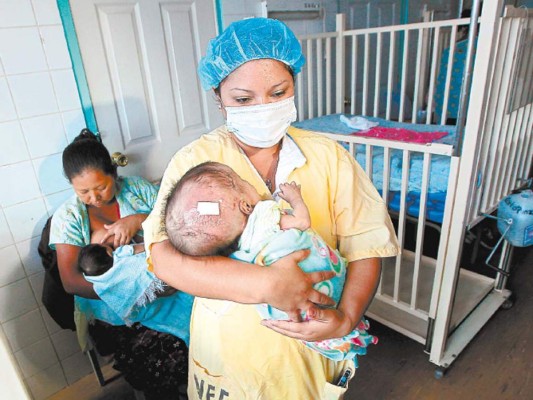 Alta incidencia de hidrocefalia